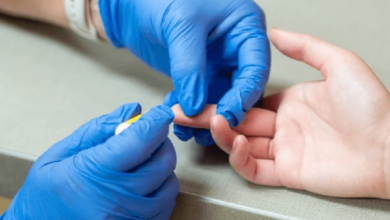 HIV Test Dubai: A Key Step in Safeguarding Your Health and Well-being