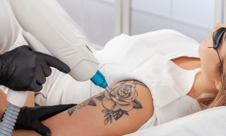 The Ultimate Guide to Erasing Unwanted Ink