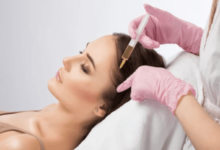 Can PRF Really Reverse Androgenetic Alopecia?